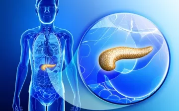 Билиарный панкреатит (БП)