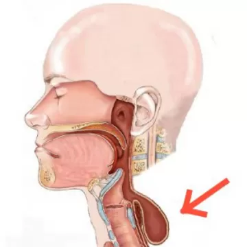 Дивертикул пищевода