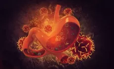 Исследование: Рак желудка перестал быть возрастным заболеванием, под угрозой пациенты до 40 лет