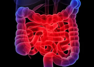 Энтероколит