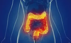 Почему воспалительные заболевания кишечника нельзя лечить самостоятельно?