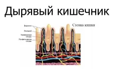 Умные клетки, которые повреждаются и умирают. Джон Макдугалл – о дырявом кишечнике