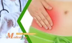 Аппендицит: какие симптомы, как определить, как лечить?