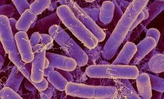 В хронической усталости могут быть «виноваты» кишечные бактерии