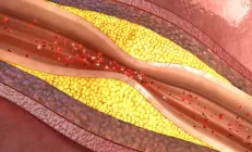 Учёные: Урсодезоксихолевая кислота предотвращает проблемы с сердцем и развитие фиброза печени