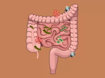 Дисбиоз кишечника: есть ли такая болезнь и как её лечить