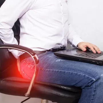 Хронический геморрой