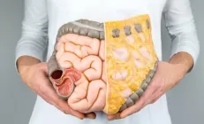 6 самых частых причин боли в толстом кишечнике