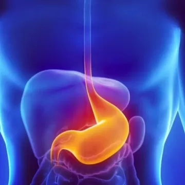 Гастрит хронический