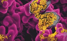 Учёные: Дисбаланс в кишечной микрофлоре приводит к затяжному COVID-19