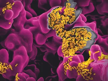 Учёные: Дисбаланс в кишечной микрофлоре приводит к затяжному COVID-19