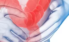 Синдром раздражённого кишечника (СРК)