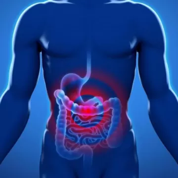 Непроходимость кишечника