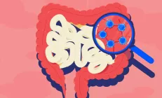 Врач-колопроктолог: «Наш организм не сарай, и никаких шлаков в нем нет»