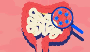 Врач-колопроктолог: «Наш организм не сарай, и никаких шлаков в нем нет»