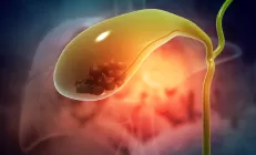 Как самостоятельно улучшить желчеотток? Кандидат медицинских наук дал рекомендации