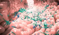 Учёные обнаружили связь между дисбактериозом и ранним раком кишечника