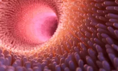 Синдром дырявого кишечника: что это такое и как его вылечить?