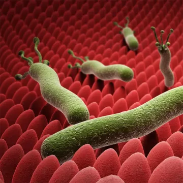 Гастрит поверхностный