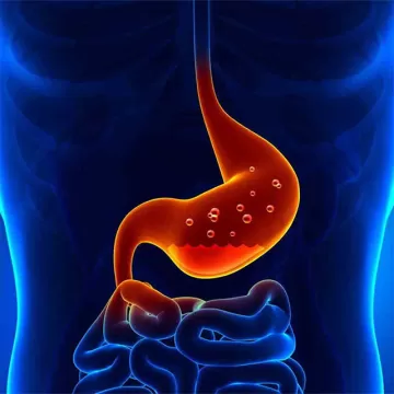 Гастрит с пониженной кислотностью