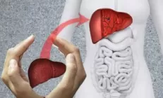 Когда лекарства бессильны. Трансплантация как метод лечения заболеваний печени