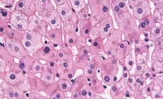 Регенерация клеток печени — всё, что вам нужно знать об этом феномене