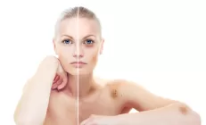 Синяки на теле – какой орган просит о помощи?