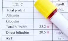 Билирубин: норма, причины повышения, анализы и лечение