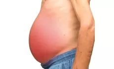 Гепатолог рассказала, чем заменить соль при асците