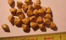 Камни в желчном пузыре. 3 популярных мифа