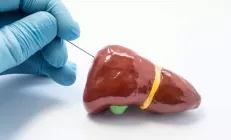 Биопсия печени: риски, как подготовиться к процедуре