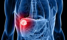 Минздрав назвал самый смертоносный вид рака в России