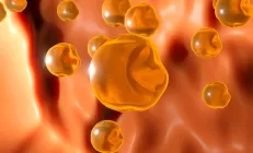 Как повышенный холестерин связан с развитием и прогрессированием жировой болезни печени?