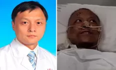 Больные коронавирусом китайские врачи почернели из-за повреждения печени