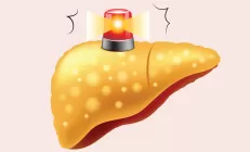 Профессор Кутушов назвал главных разрушителей печени