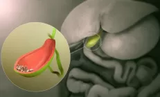 Для чего нужна желчь?