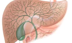 7 правил жизни с перегибом желчного пузыря