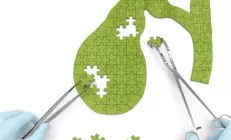 Врач объяснил, нужно ли бояться перегиба желчного пузыря