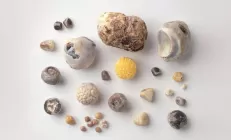 Врач-хирург: У женщин камни в желчном пузыре появляются в 1,5 раза чаще, чем у мужчин