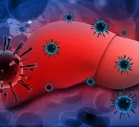 Гепатит C: симптомы и лечение