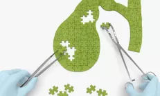 6 способов предотвратить застой желчи