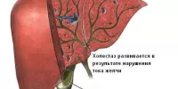 Холестаз: причины, симптомы и лечение