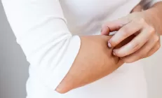 Кожный зуд без аллергии. Почему проблему нужно искать в печени?