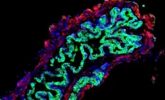 Искусственные желчные протоки помогут в лечении заболеваний печени