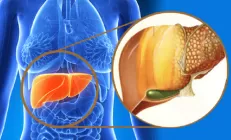 Исследование: От ожирения печени страдают поджелудочная и почки