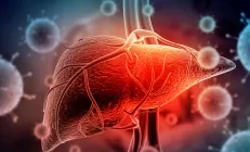 Онколог Бредер: Количество людей с невирусными гепатитами растёт