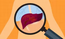 Медики: 70% людей с диабетом 2-го типа имеют стеатоз печени