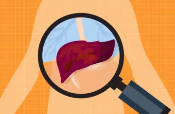 Стеатоз печени и синдром раздраженного кишечника: как они связаны