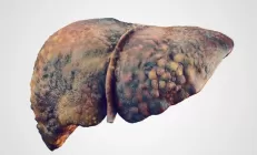 Печень: функции, заболевания и профилактика - ответы на частые вопросы