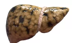 Неалкогольная жировая болезнь печени почти на 40% повышает риск деменции